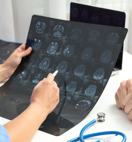Two people review a brain MRI scan in a medical office. One points at the images with a pen, while a stethoscope lies on the desk, suggesting a clinical setting.